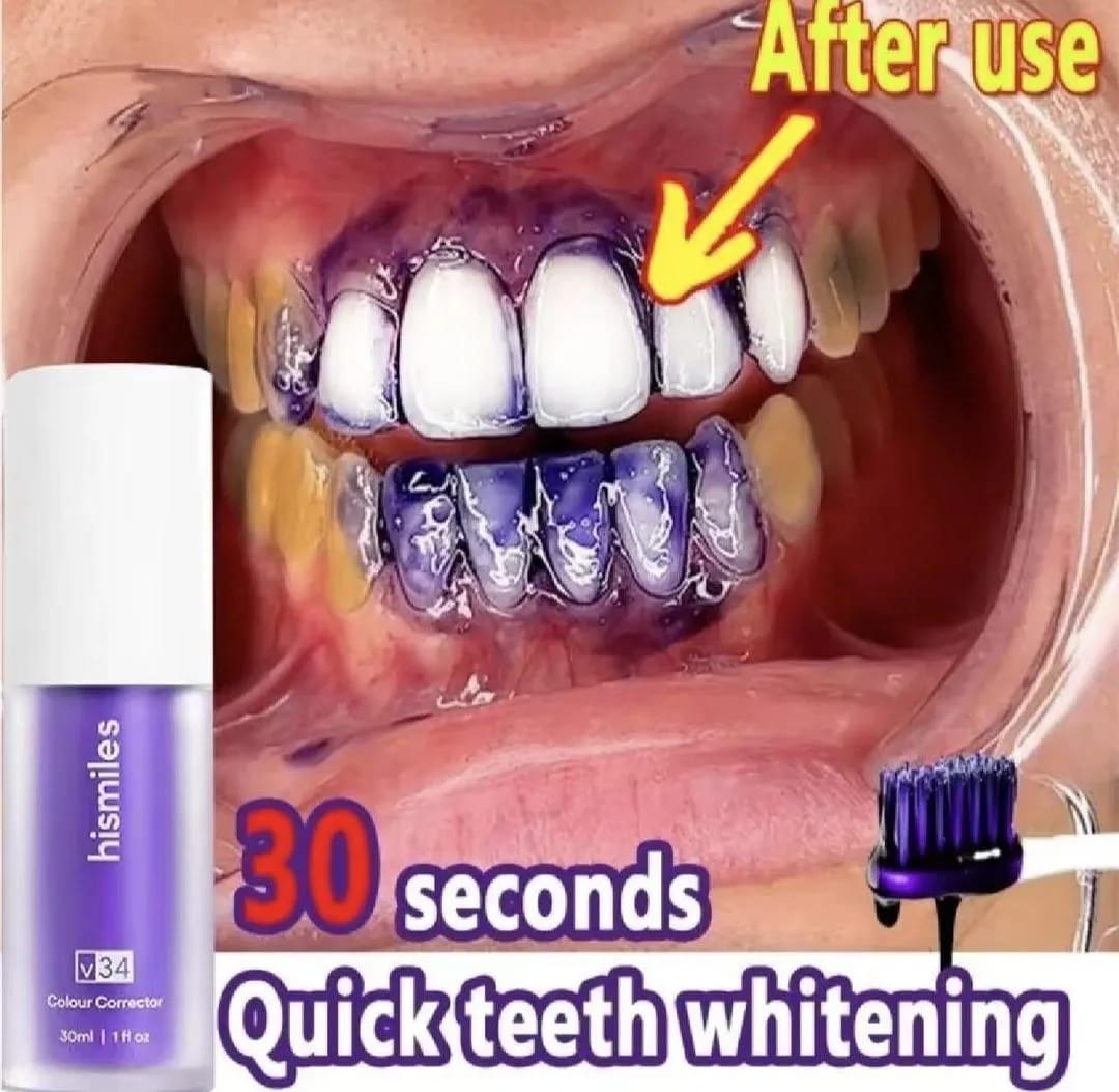 Teeth Whitening V34 Serum 30mL Purple.